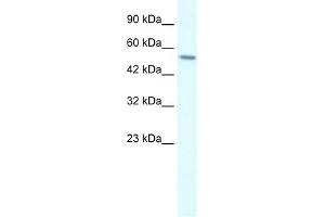 WB Suggested Anti-RGS6 Antibody Titration:  0. (RGS6 antibody  (C-Term))