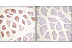 Immunohistochemistry analysis of paraffin-embedded human skeletal muscle tissue, using TNNI3 (Ab-142) Antibody. (TNNI3 antibody  (AA 111-160))