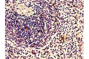 Immunohistochemistry of paraffin-embedded human spleen tissue using ABIN7165052 at dilution of 1:100 (ZBTB8OS antibody  (AA 2-136))