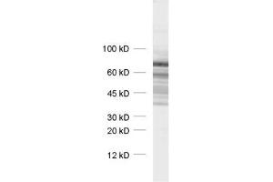 dilution: 1 : 1000, sample: synaptic vesicle fraction of rat brain (LP2) (Synapsin III antibody  (AA 417-434))