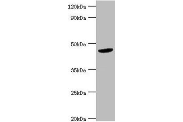 BCKDK anticorps  (AA 153-412)