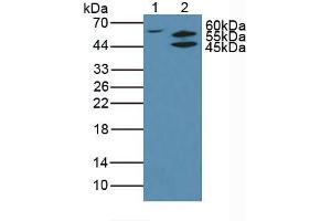Figure. (AKT2 antibody  (AA 142-412))