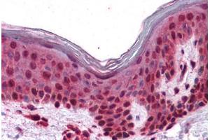 Human Skin: Formalin-Fixed, Paraffin-Embedded (FFPE) (SLC5A6 antibody  (N-Term))