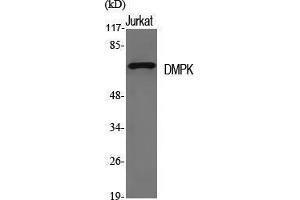Western Blotting (WB) image for anti-Dystrophia Myotonica-Protein Kinase (DMPK) (N-Term) antibody (ABIN3174775) (DMPK antibody  (N-Term))