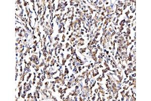 IHC analysis of NOLA1/GAR1 using anti-NOLA1/GAR1 antibody (ABIN7602076). (GAR1 antibody  (AA 58-165))