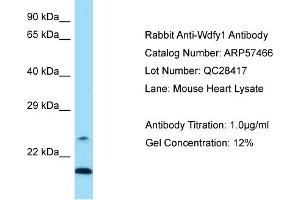Western Blotting (WB) image for anti-WD Repeat and FYVE Domain Containing 1 (WDFY1) (N-Term) antibody (ABIN2787238) (WDFY1 antibody  (N-Term))