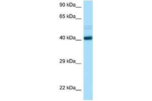 WB Suggested Anti-CCNB2 AntibodyTitration: 1. (Cyclin B2 antibody  (C-Term))