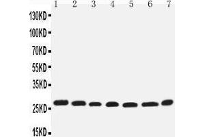Western Blotting (WB) image for anti-Eukaryotic Translation Initiation Factor 6 (EIF6) (AA 82-96), (Middle Region) antibody (ABIN3044059)