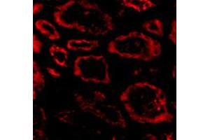 Immunofluorescence of SKI in human kidney tissue with SKI polyclonal antibody  at 20 ug/mL .