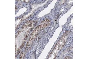 Immunohistochemical staining of human kidney with MYO18B polyclonal antibody  shows moderate cytoplasmic positivity in renal tubules.
