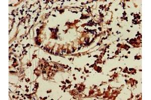 Immunohistochemistry of paraffin-embedded human appendix tissue using ABIN7172340 at dilution of 1:100 (TNIK antibody  (AA 523-714))