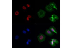 ABIN6258503 and ABIN6274617 staining Hela by IF/ICC.