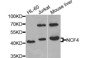 Western blot analysis of extracts of various cell lines, using NCF4 antibody (ABIN5971122) at 1/1000 dilution. (NCF4 antibody)