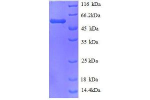 Carbonyl Reductase 1 (CBR1) (AA 2-277), (full length) protein (GST tag) (CBR1 Protein (AA 2-277, full length) (GST tag))