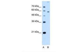 Image no. 1 for anti-Solute Carrier Family 22 (Organic Cation Transporter), Member 2 (SLC22A2) (N-Term) antibody (ABIN320833) (SLC22A2 antibody  (N-Term))