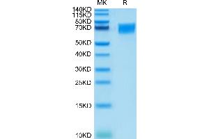 Human CD58 on Tris-Bis PAGE under reduced condition. (CD58 Protein (CD58) (AA 29-215) (Fc Tag))
