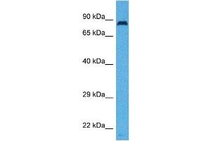 Host:  Rabbit  Target Name:  SLC26A4  Sample Tissue:  Human Ovary Tumor  Antibody Dilution:  1ug/ml (SLC26A4 antibody  (Middle Region))