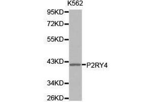 Western Blotting (WB) image for anti-Pyrimidinergic Receptor P2Y, G-Protein Coupled, 4 (P2RY4) antibody (ABIN1874015) (P2RY4 antibody)