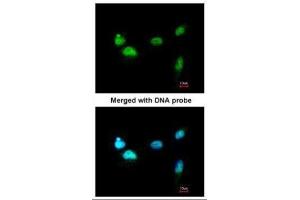 ICC/IF Image Immunofluorescence analysis of paraformaldehyde-fixed A549, using SCMH1, antibody at 1:200 dilution. (SCMH1 antibody  (Center))