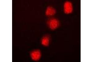 Immunofluorescent analysis of BRG1 staining in Hela cells. (SMARCA4 antibody)