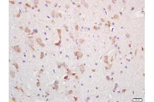 Formalin-fixed and paraffin embedded rat brain labeled with Rabbit Anti-MCHR Polyclonal Antibody, Unconjugated (ABIN719051) at 1:200 followed by conjugation to the secondary antibody and DAB staining (MCHR1 antibody  (AA 75-180))