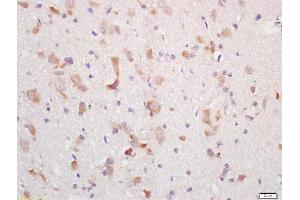 Formalin-fixed and paraffin embedded rat brain labeled with Rabbit Anti-MCHR Polyclonal Antibody, Unconjugated (ABIN719051) at 1:200 followed by conjugation to the secondary antibody and DAB staining