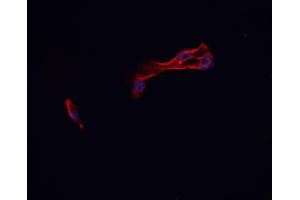 ABIN6276942 staining HepG2? (CADM1 antibody  (Internal Region))