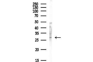 Western blot analysis of lysates from Hela cells(UV, 30 min treatment), using SPIN Antibody at 1/1000 dilution.