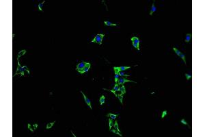 Immunofluorescence staining of MCF-7 cells with ABIN7167210 at 1:100, counter-stained with DAPI. (MRAS antibody  (AA 1-205))