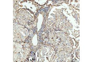 IHC analysis of ICAM1 using anti-ICAM1 antibody (ABIN5692991).
