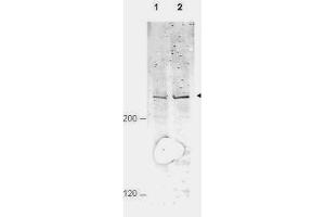 Western blot using  Affinity Purified anti-APC1 pS377 antibody shows detection of a band ~215 kDa corresponding to phosphorylated human APC1 (arrowhead). (APC1 antibody  (pSer377))