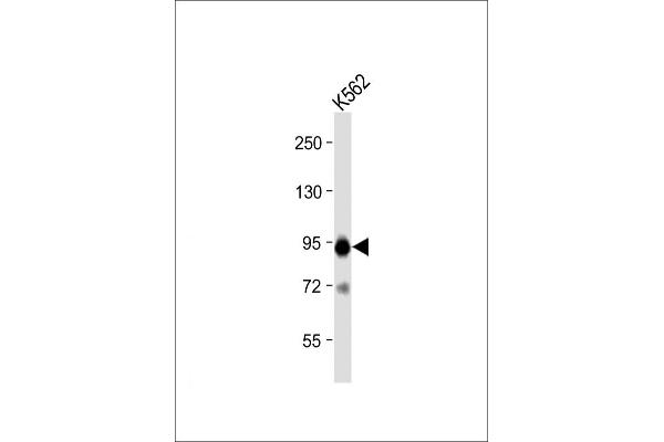 SNRPE 抗体  (AA 424-453)