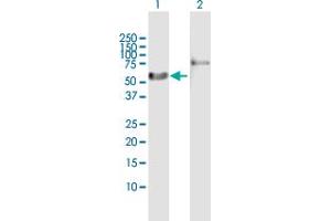 Western Blot analysis of RARA expression in transfected 293T cell line by RARA MaxPab polyclonal antibody. (Retinoic Acid Receptor alpha antibody  (AA 1-462))