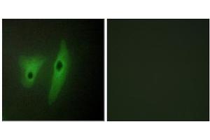 Immunofluorescence analysis of HeLa cells, using DUS19 antibody. (DUSP19 antibody  (Internal Region))