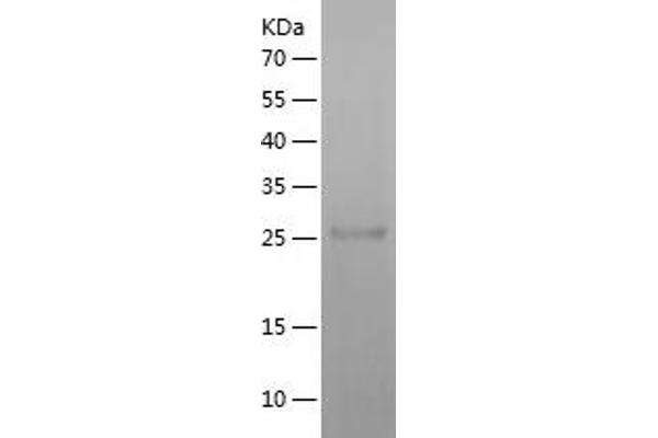 TSH receptor Protein (AA 22-260) (His tag)