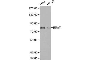 Western blot analysis of extracts of various cell lines, using BRAF antibody. (BRAF antibody)