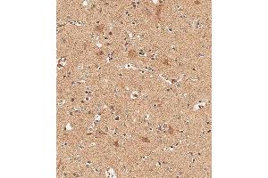 Immunohistochemistry (Paraffin-embedded Sections) (IHC (p)) image for anti-delta Like Protein 3 (DLL3) (AA 545-573), (C-Term) antibody (ABIN656327)