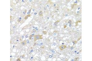 Immunohistochemistry (Paraffin-embedded Sections) (IHC (p)) image for anti-Inositol Polyphosphate-5-Phosphatase K (INPP5K) antibody (ABIN7011997)