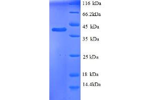 SDS-PAGE (SDS) image for TNF Receptor Superfamily, Member 6 (FAS) (AA 2155-2495), (partial) protein (His tag) (ABIN5712846)