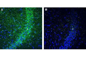 Expression of GPR160 in mouse hippocampus.