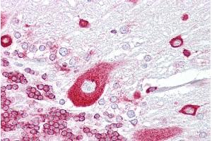 Immunohistochemistry with Brain, cerebellum tissue at an antibody concentration of 5µg/ml using anti-PURA antibody (ARP33202_P050) (PURA antibody  (Middle Region))