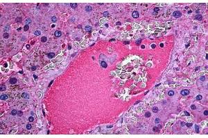 Human Liver: Formalin-Fixed, Paraffin-Embedded (FFPE) (Haptoglobin antibody)