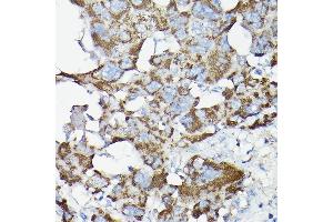 SLC14A1 antibody  (C-Term)