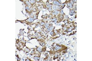 Immunohistochemistry of paraffin-embedded rat liver using SLC14 Rabbit pAb (5991) at dilution of 1:200 (40x lens). (SLC14A1 antibody  (C-Term))
