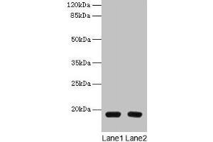Western blot All lanes: PDE6D antibody at 1. (PDE6D antibody  (AA 1-150))