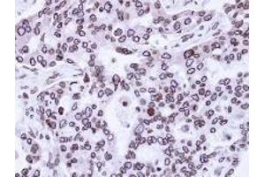 Immunohistochemistry: Lamin A/C antinbody staining of Paraffin-Embedded H441 Xenograft at 1/100 dilution.