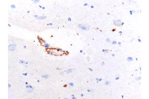Immunohistochemistry (IHC) image for anti-SARS-CoV-2 Spike (C-Term) antibody (ABIN1030641)