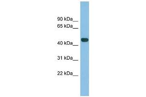 WB Suggested Anti-TFB2M Antibody Titration: 0.
