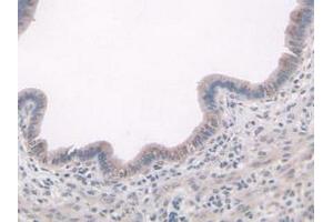 Detection of ADAMTS7 in Mouse Uterus Tissue using Polyclonal Antibody to A Disintegrin And Metalloproteinase With Thrombospondin 7 (ADAMTS7) (ADAMTS7 antibody  (AA 226-437))