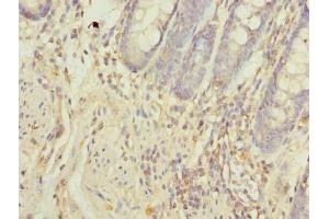 Immunohistochemistry of paraffin-embedded human colon tissue using ABIN7162093 at dilution of 1:100 (FAM55A antibody  (AA 1-405))